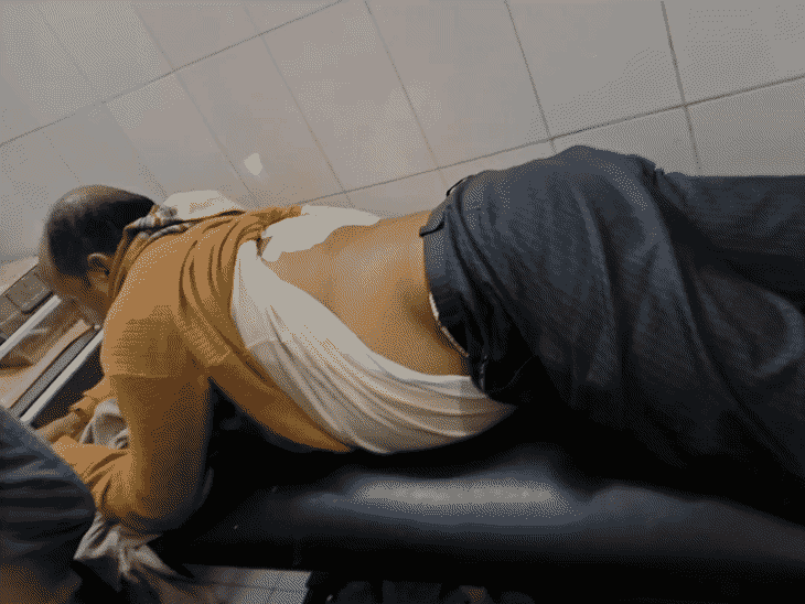 गोरखपुर में बदमाशों ने भाजपा नेता को गोली मारी:बाइक सवारों ने किया हमला, पीठ में धंसी गोली, जिला अस्पताल में चल रहा इलाज